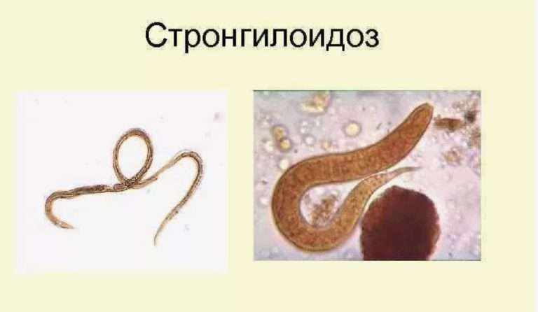 Стронгилоидоз у свиней: признаки, лечение, профилактика